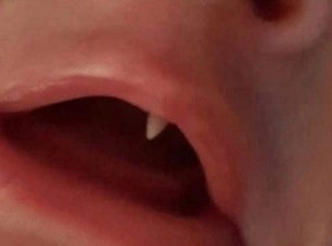 В Ирландии у ребёнка вырос клык за ночь. Родители и врачи были в шоке. Вампиры среди нас... zdms - 3