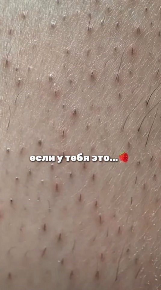   - 2