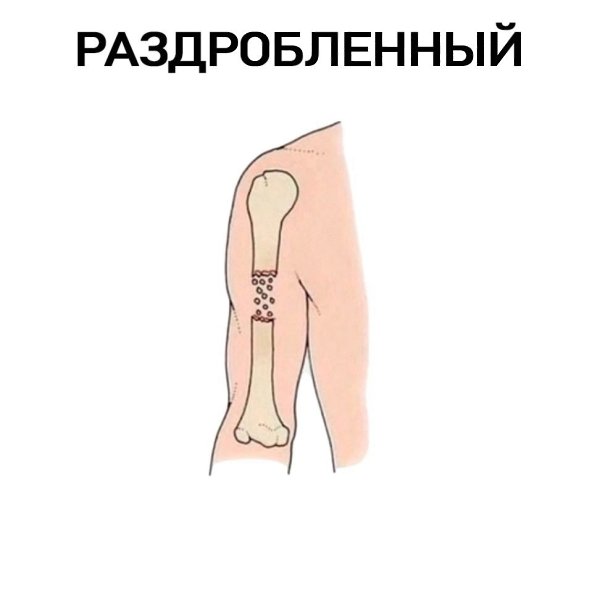  ? - 2