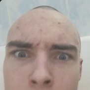 ������, 18 ���, �����������