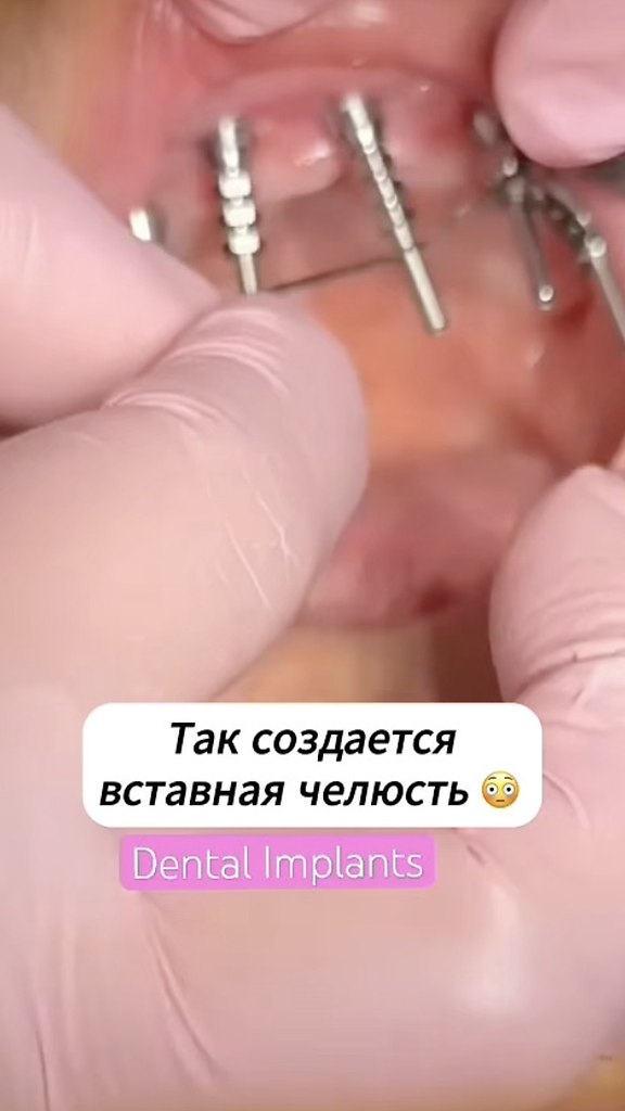   .
