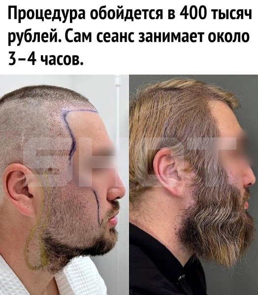  ... - 3