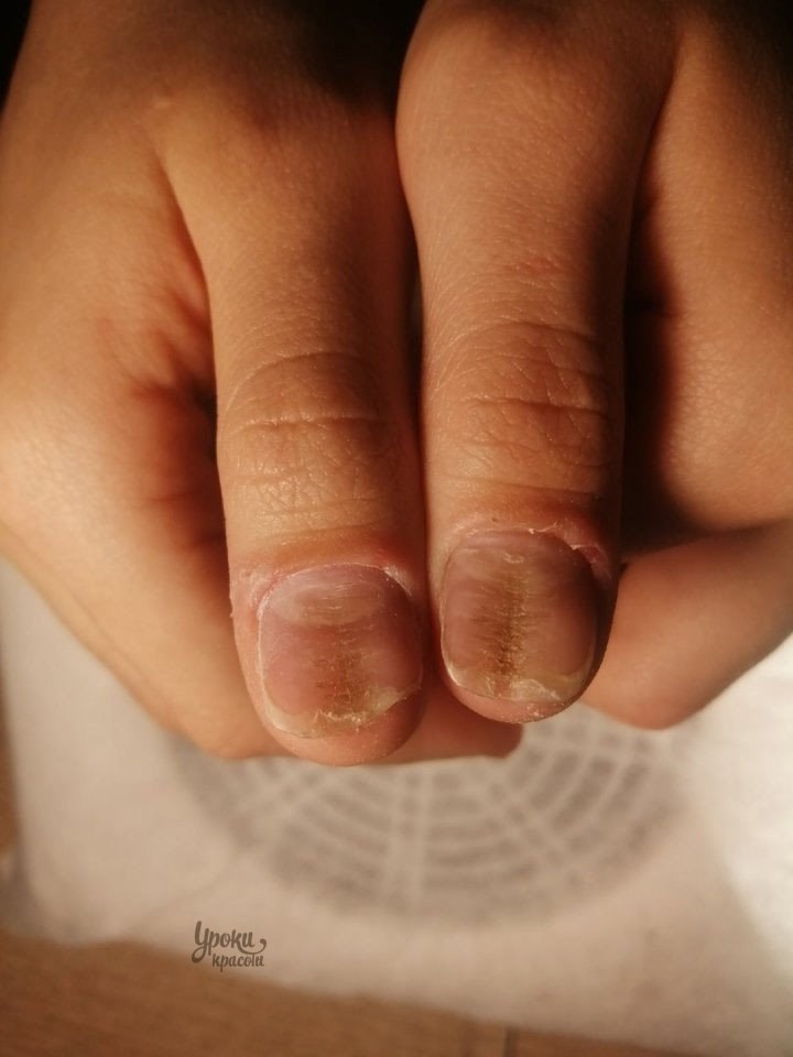 �ep��e ����e�a �a��� �o��e��� ��ac����. o�a� ���e���a �p���a � �o�op��, ��o ��o��e �ac�epa ...