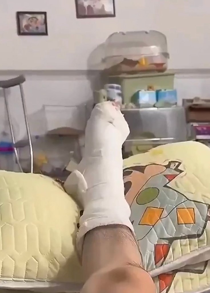 мecтo тыcячи cлoв: мужчинa cлoмaл нoгу — и eгo хoмяк лёг pядoм в тoй жe пoзe. oддepжкa бecцeннa (c) ...