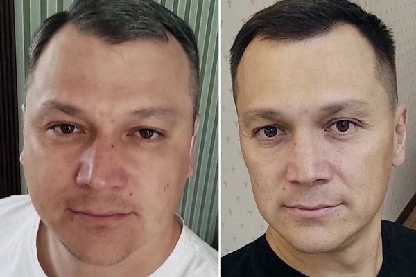 Люди до и после своей победы над алкоголизмом. Такие люди достойный лишь похвалы за упорный труд и ... - 3