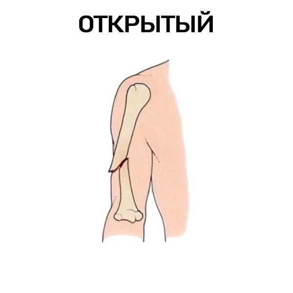  ? - 3