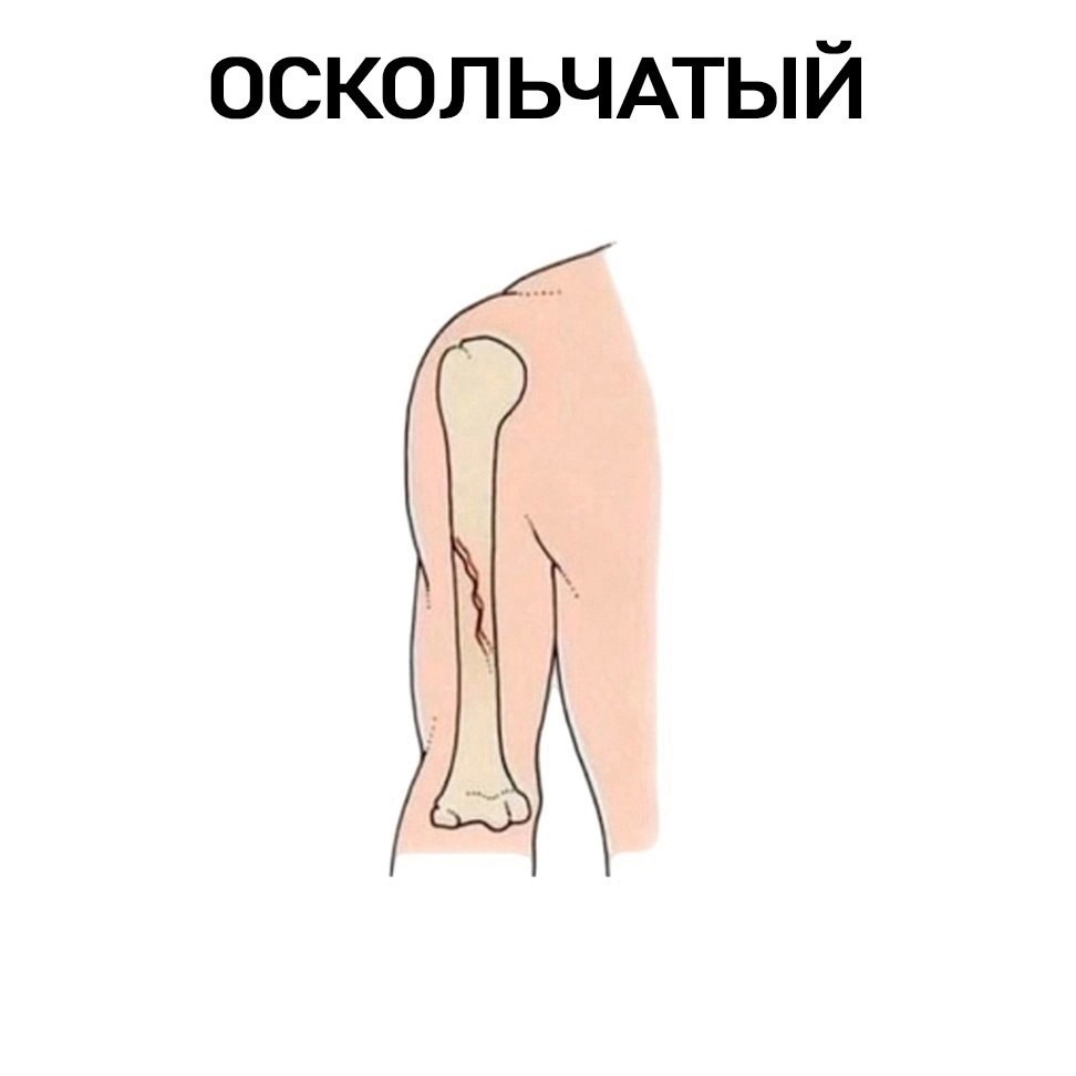  ? - 5