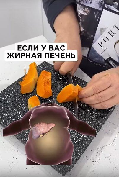 При наличии жирового гепатоза печени важно полностью исключить из рациона следующие категории ...