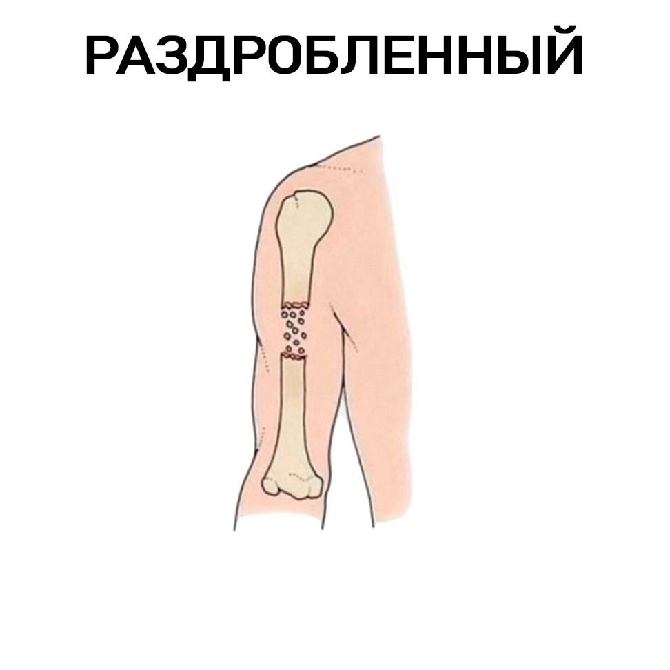  ? - 2