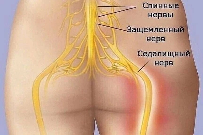 После Операция Позвоночника Когда Можно Заниматься Сексом