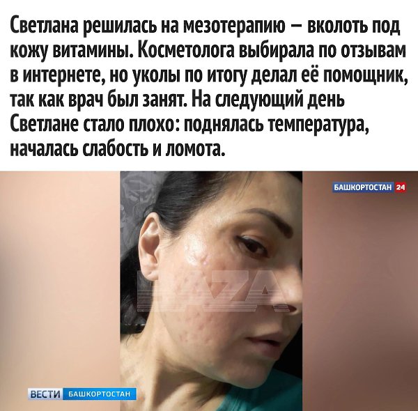   ,     - 2