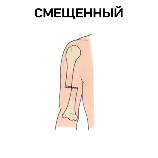  ? - 4