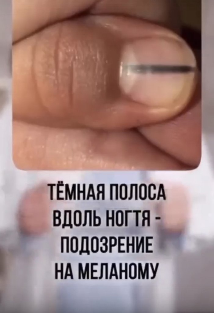       ? - 2