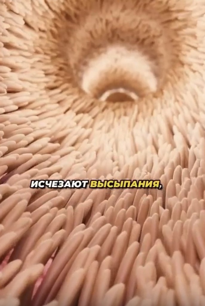        -  - 2