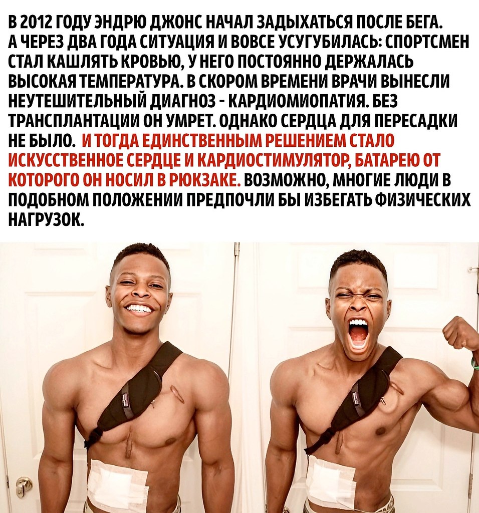      - 2