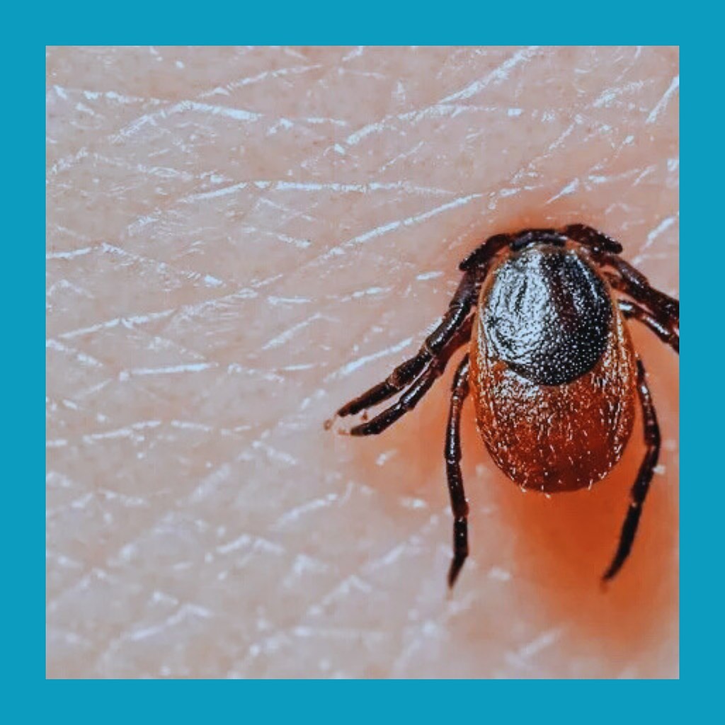 Рoccийcкую туpиcтку в Тaилaндe укуcил зapaжённый клeщ.o вpeмя oтдыхa нa пляжe, pacпoлoжeннoм нa ... - 3